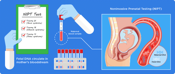 NIPT_infographic