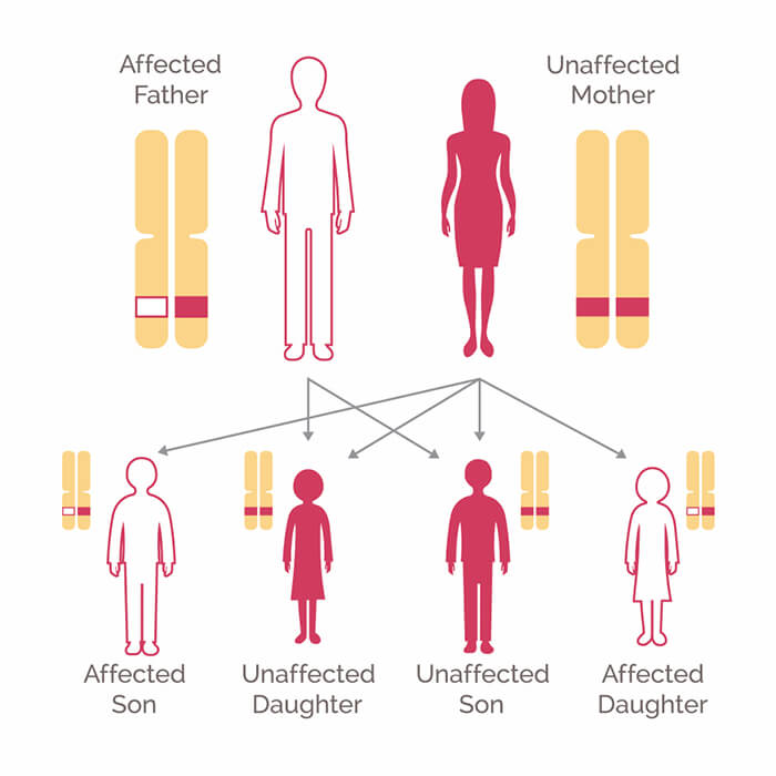 who-should-be-tested-for-brca-700x700